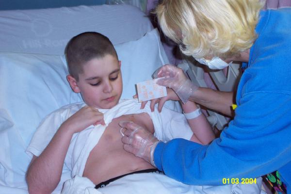 Billy's broviac catheter dressing change